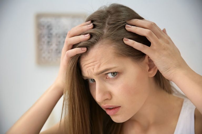 hair loss female